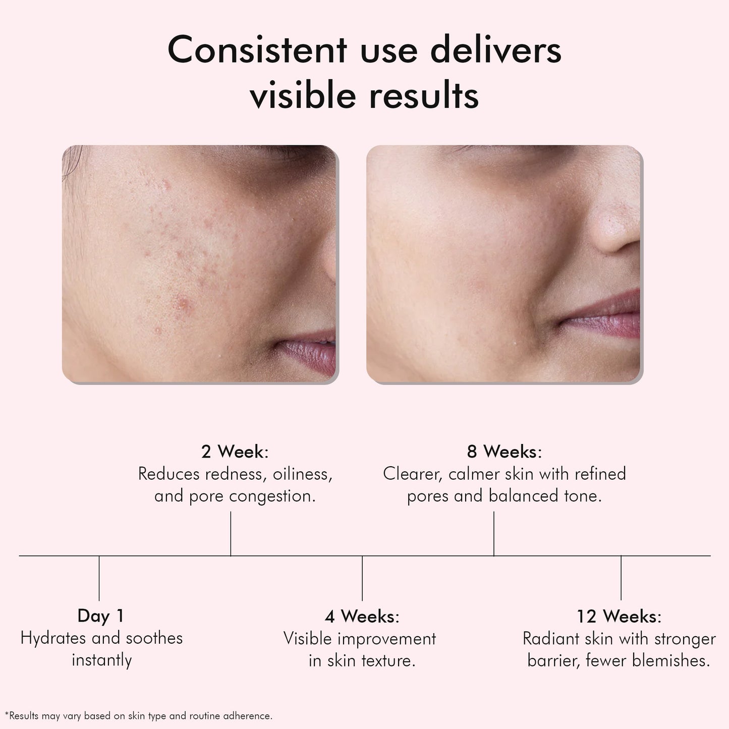 Red Vine Deep Facial Cleanser with Witch Hazel Extract