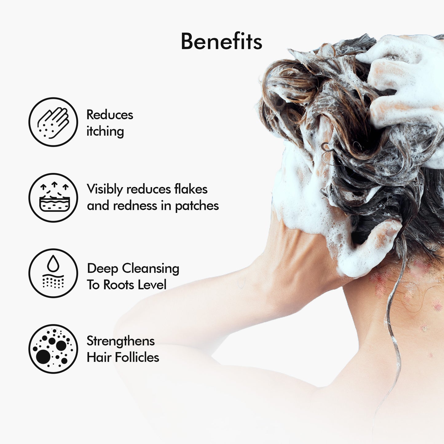 Plasma Bamboo Charcoal Shampoo for Psoriasis & Sensitive Scalp