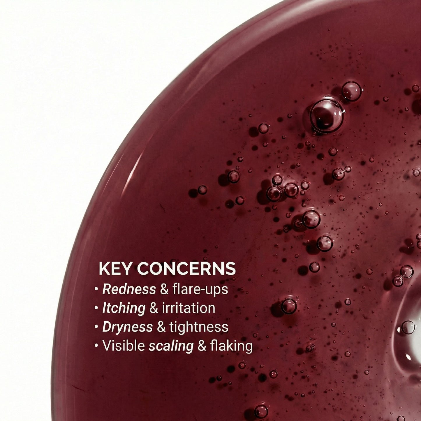 Vedicderm Psoriasis Oil | 2-in-1 Skin + Scalp Relief Oil