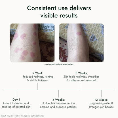 Vedicderm Skin and Scalp Psoriasis Oil