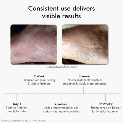 Vedicderm Ultimate Psoriasis Care Bundle