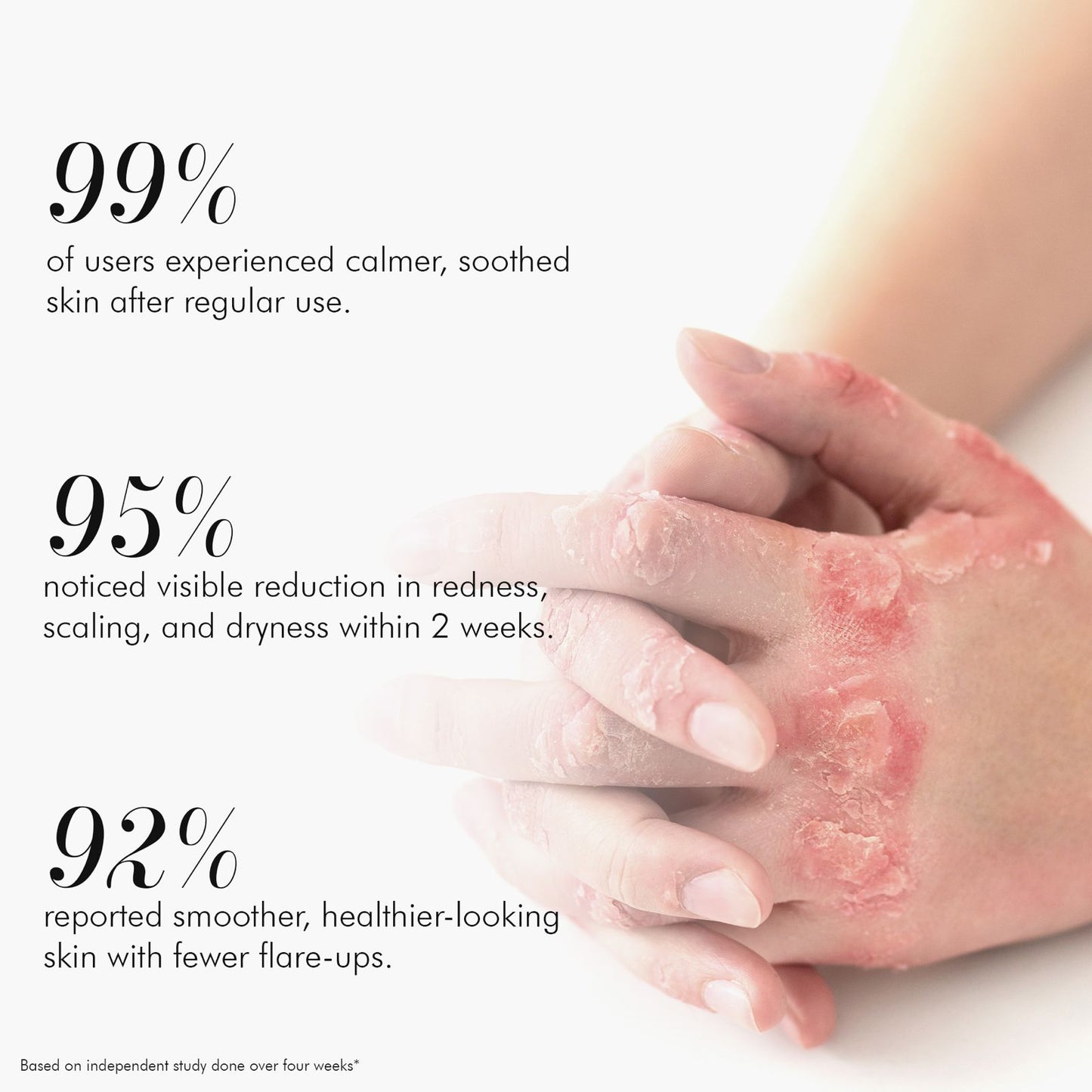 Vedicderm Ultimate Psoriasis Care Bundle