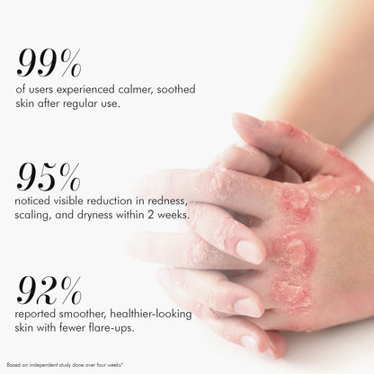 Vedicderm Ultimate Psoriasis Care Bundle