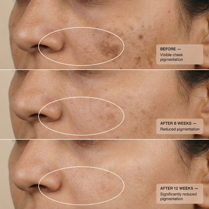 Kumkumadi De Pigmentation Night Cream with Saffron & Ceramides