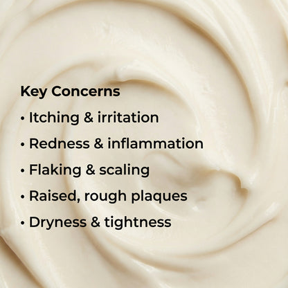 Vedicderm Psoriasis Cream with 2% Bakuchi Extract - New and Improved Pack