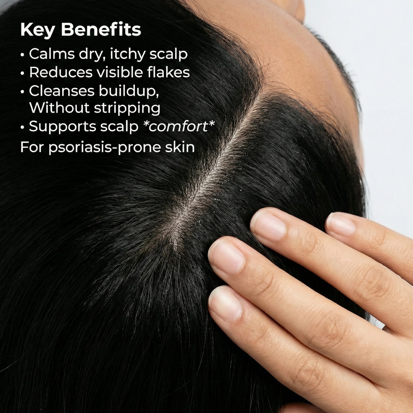 Sensitive Scalp Bundle for Psoriasis, Dandruff, & Itchy Scalp