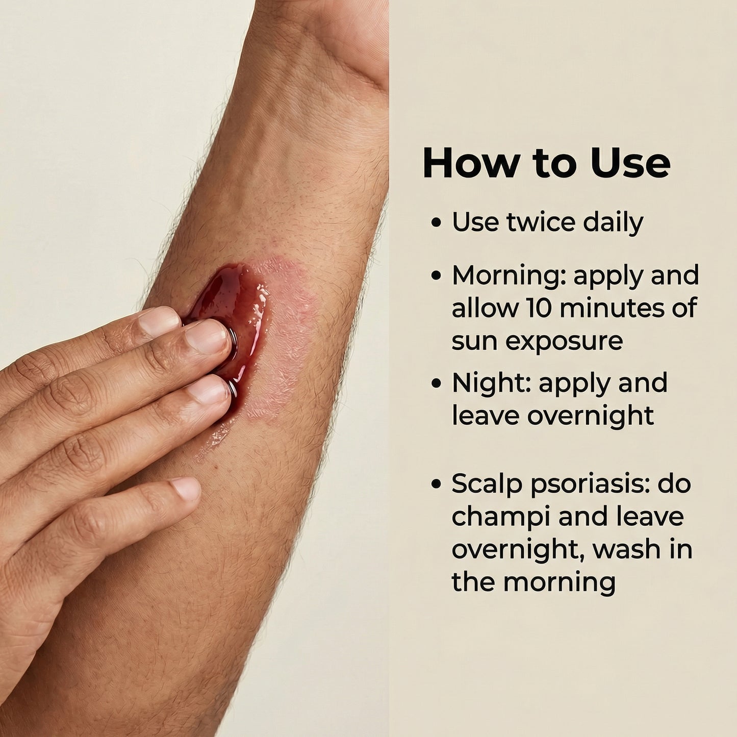 Vedicderm Psoriasis Oil | 2-in-1 Skin + Scalp Relief Oil