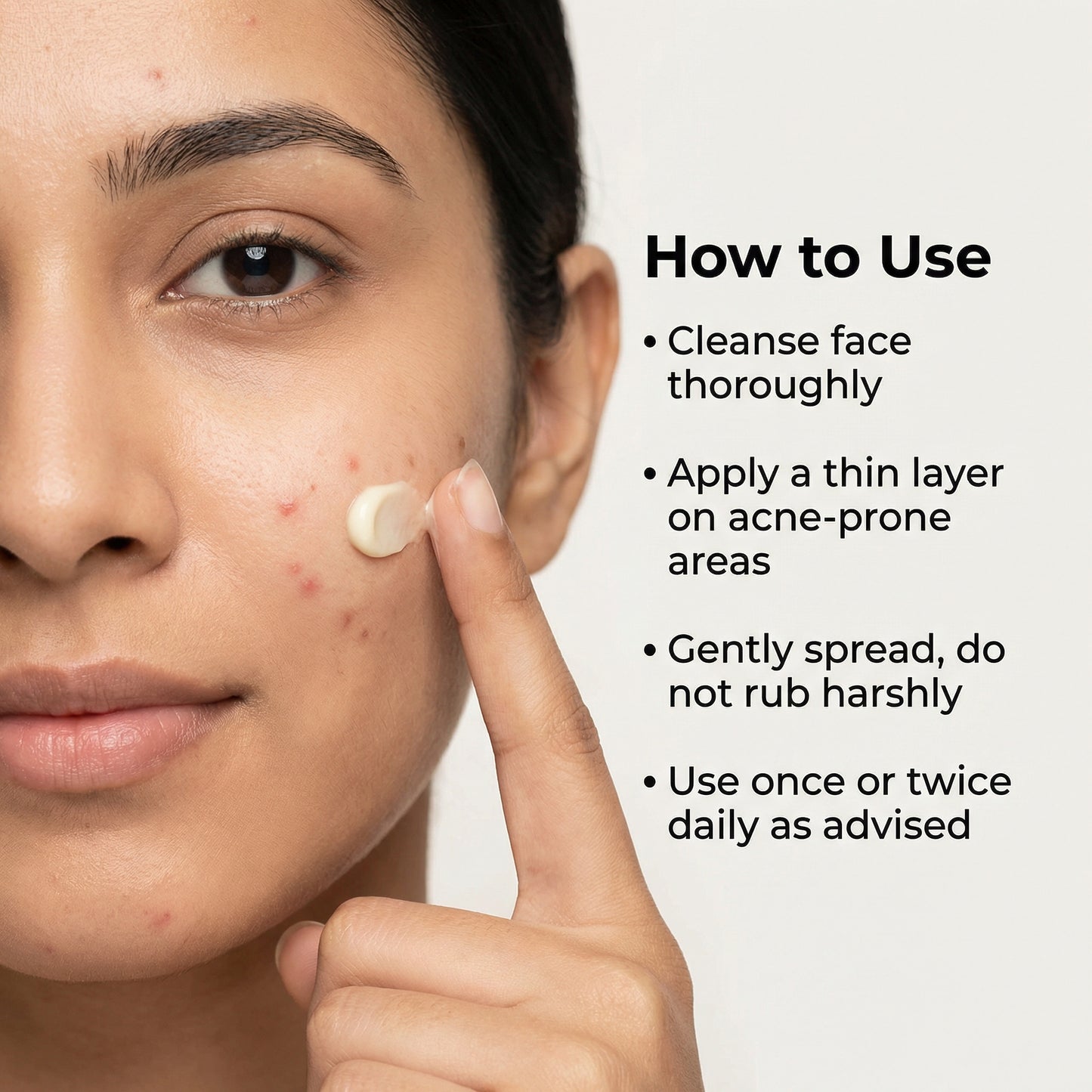 Nano Gold Acne Defence Cream with Turmeric and Nia-Cera-Peptide Complex™️