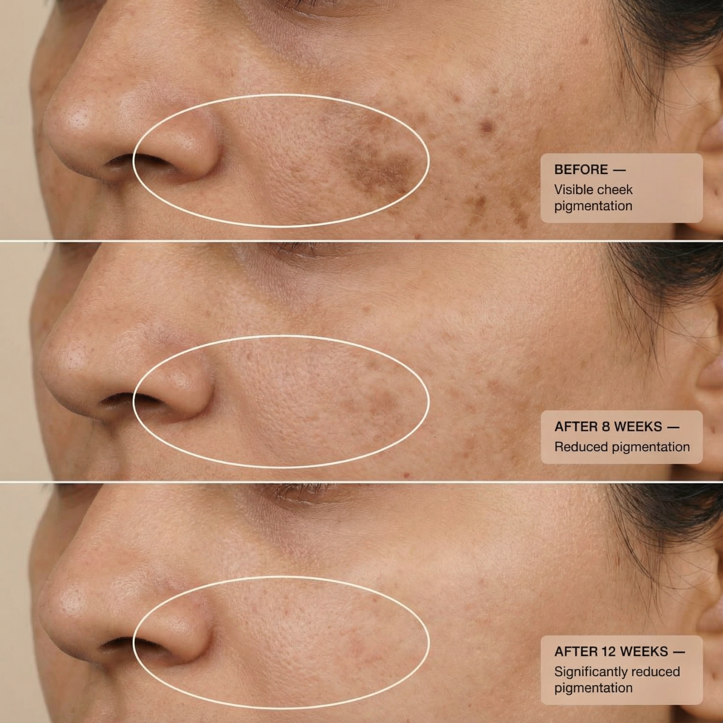 Kumkumadi De Pigmentation Night Cream with Saffron & Ceramides