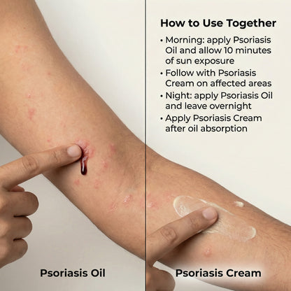 Sensitive Skin Bundle for Psoriasis, Eczema, Atopic Dermatitis