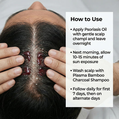 Sensitive Scalp Bundle for Psoriasis, Dandruff, & Itchy Scalp